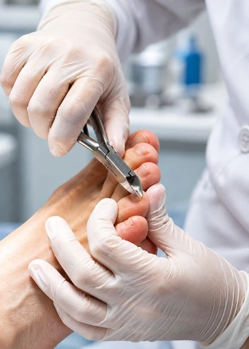 Corte Técnico das Unhas